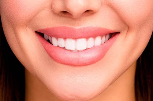 Smile Design