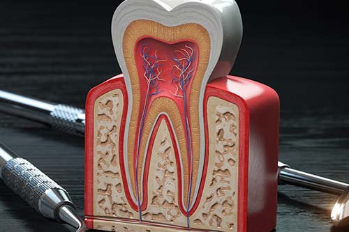 Root Canal Treatment