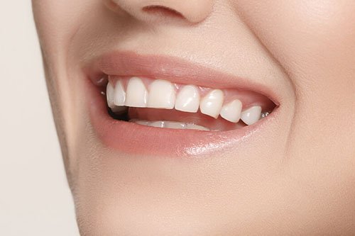 Zirconium Crowns